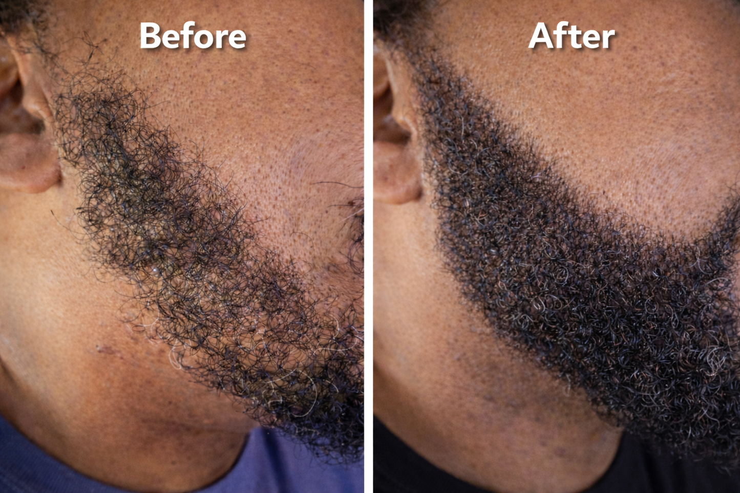 Long Hair & Unbothered™ Hair Growth Oil