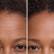 Radiance Renewal LED Mask