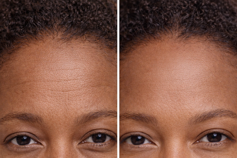 Radiance Renewal LED Mask