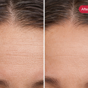 Radiance Renewal LED Mask