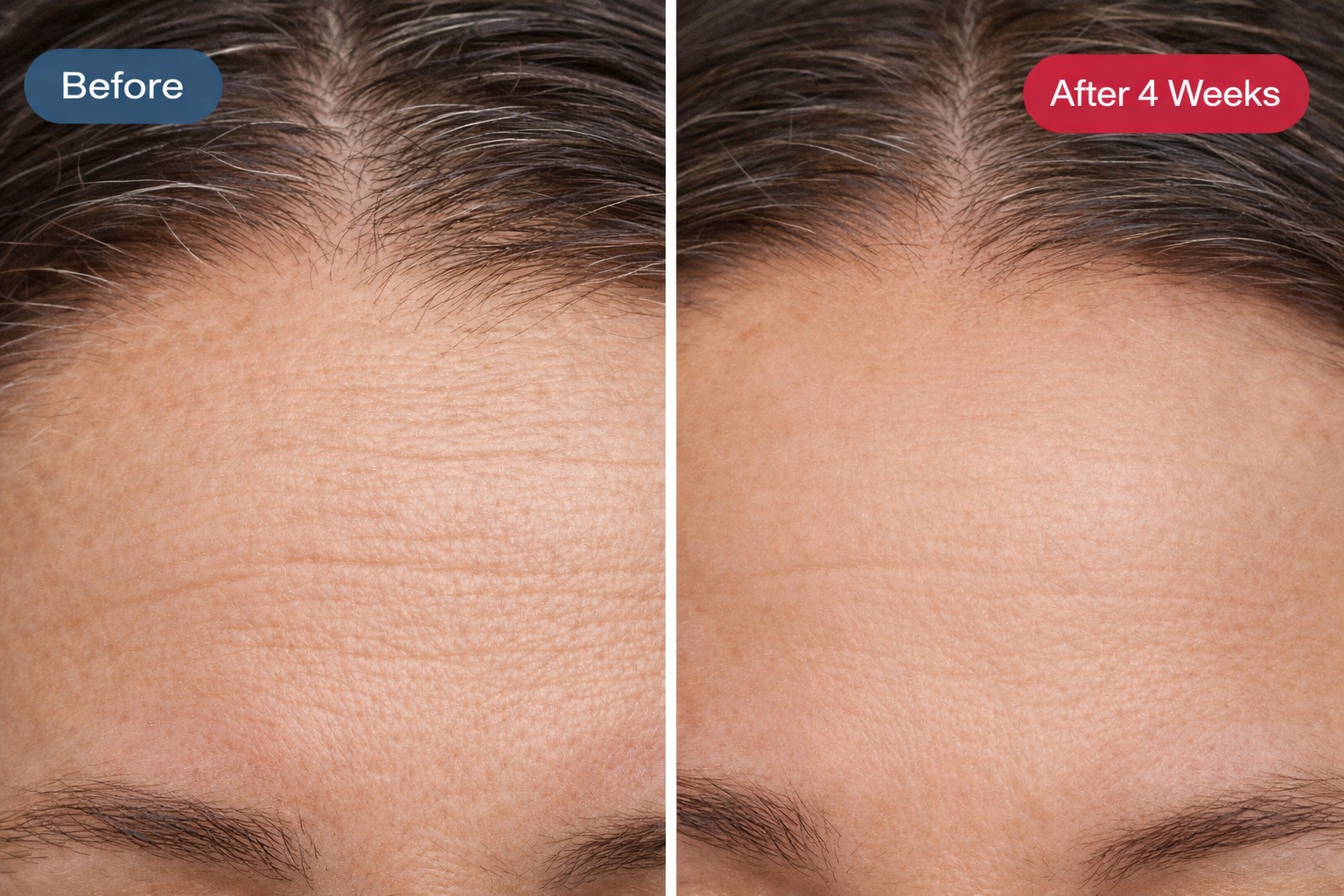 Radiance Renewal LED Mask