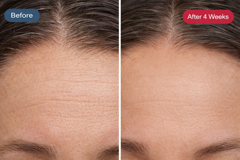 Radiance Renewal LED Mask