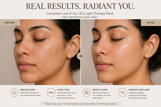 Radiance Renewal LED Mask